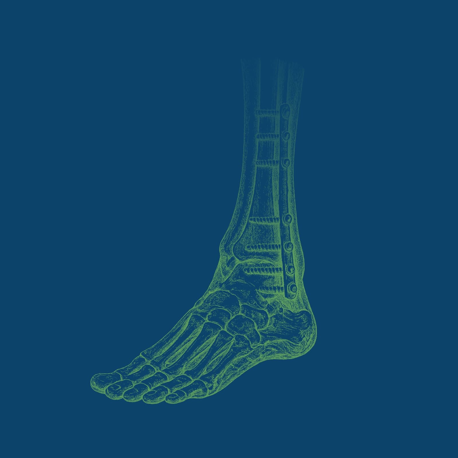 Osteosíntesis