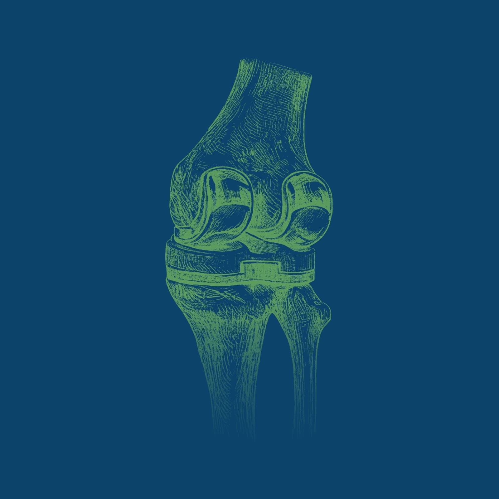 Reemplazo Articular